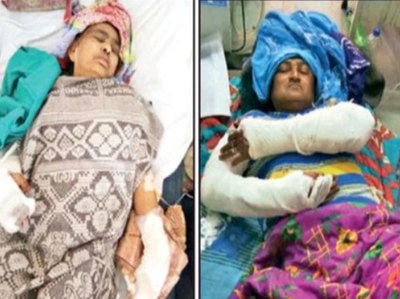بجرنگ دل کارکن نے مسلم خاتون کی انگلی اور بیٹا کے ہاتھ کاٹ دیا