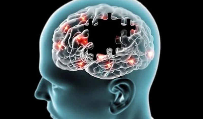 दिमाग में आयरन की मौजूदगी अल्जाइमर का कारण बन सकती है