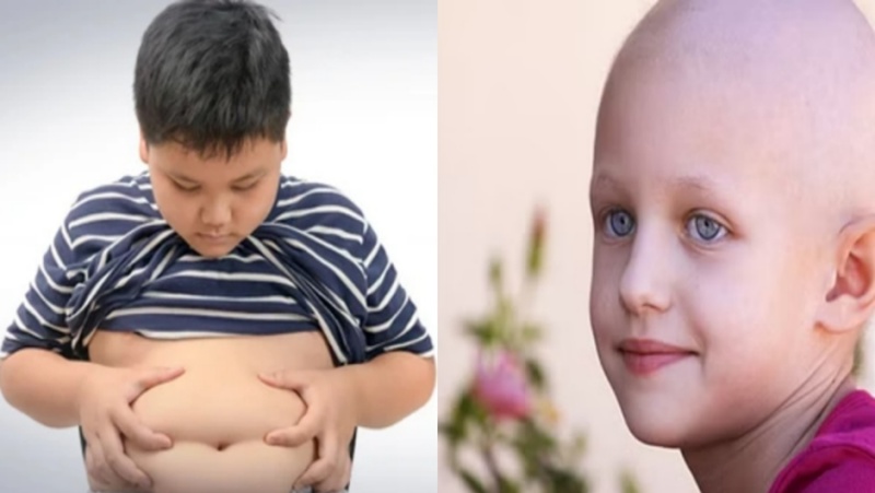 बचपन का मोटापा आगे चलकर कैंसर का कारण बन सकता है