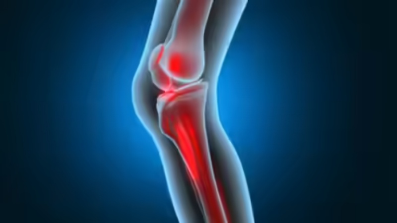 महिलाओं के साथ अब पुरुषों की भी समस्या हो गई है कैल्शियम की कमी- विशेषज्ञ