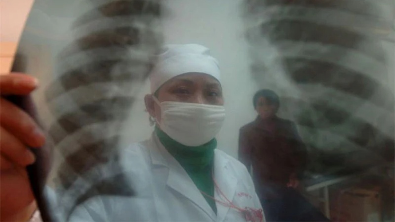 कोविड-19 के मरीज़ों में वक़्त से पहले हो रहे है बुढ़ापे के लक्षण, महिलाएं ज़्यादा प्रभावित
