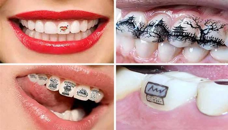 त्वचा के टैटू से एक कदम आगे जाकर चीनी युवा अब दांतों पर टैटू बनवा रहे हैं