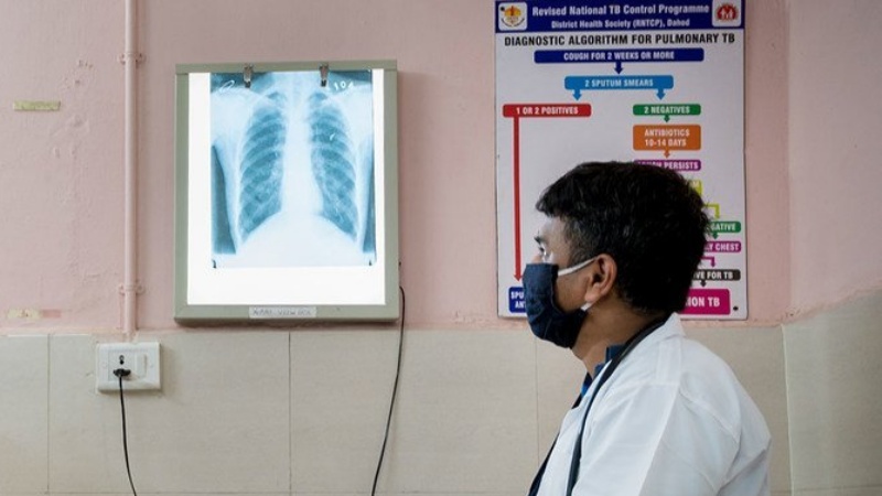 टीबी का अन्त करने की मुहिम पर धन की कमी का संकट