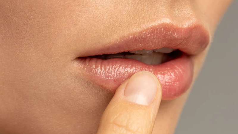 सर्दियों में होंठ सूखने का कारण संतुलित खाने की कमी भी हो सकती है
