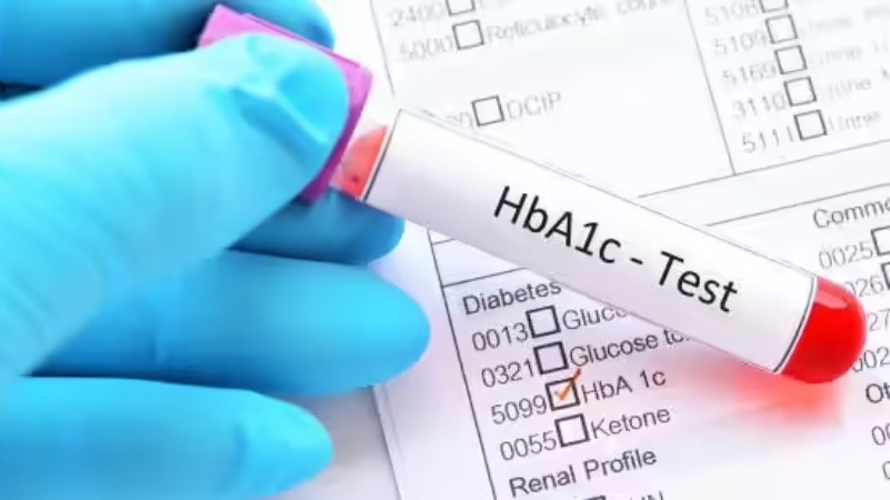 धुरंधर के टाइटल ट्रैक पर थिरकीं रशियन-जॉर्जियन स्केटर अनास्तासिया गुबानोवा