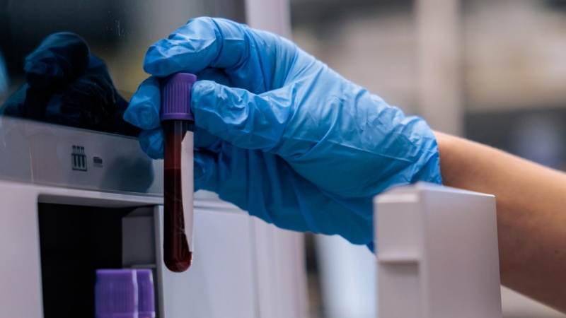 वैज्ञानिकों ने डिमेंशिया के खतरे का 25 साल पहले ही पता लगाने वाला एक ब्लड टेस्ट बनाया